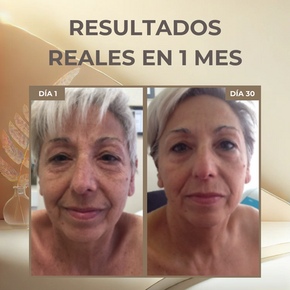 Skin Renew™ Sérum Anti‑Edad